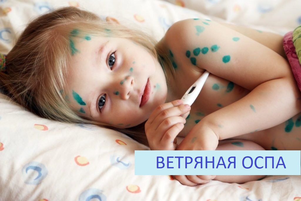vetryanka 1536x1024 1 1024x683